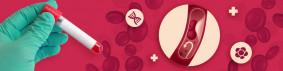 5 Best At-Home Cholesterol Test Kits in 2025