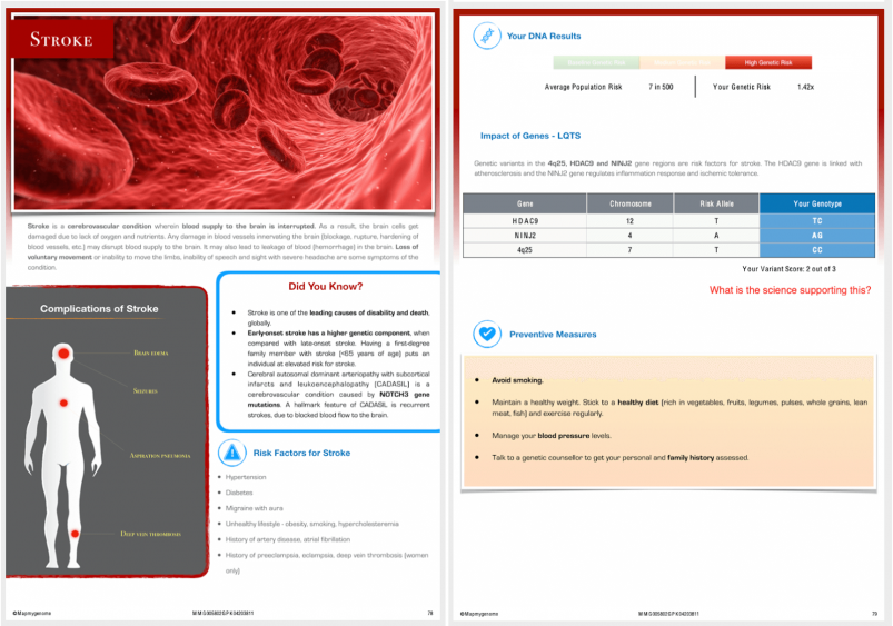 Mapmygenome's Genomepatri Report Pages on My Risk of Stroke